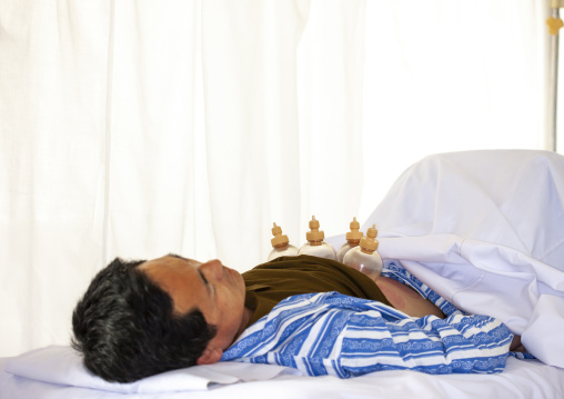 North Korean man having traditional cupping medicine in Koryo hospital, DGC, Pyongyang, North Korea