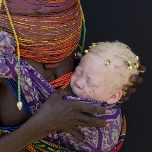 Albino Mwila Baby, Angola