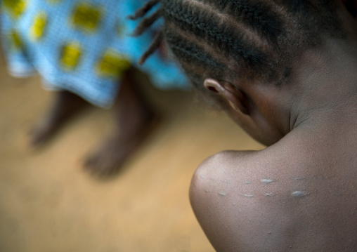 Benin, West Africa, Bopa, woman with traditional scarifications on the back during a voodoo ceremony