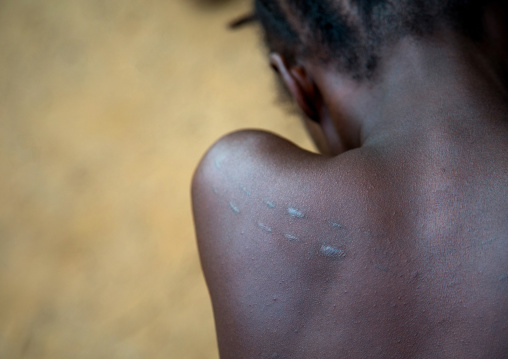 Benin, West Africa, Bopa, woman with traditional scarifications on the back during a voodoo ceremony