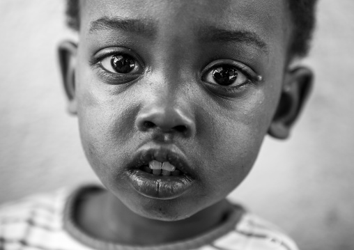 Mingi Baby Rescued In Omo Child Foundation, Jinka, Omo Valley, Ethiopia