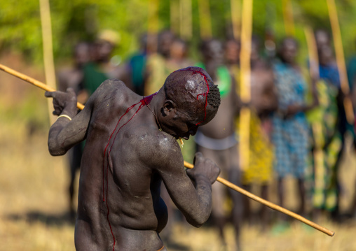 Suri tribe warrior bleeding during a donga stick fighting ritual, Omo valley, Kibish, Ethiopia