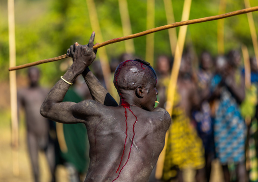 Suri tribe warrior bleeding during a donga stick fighting ritual, Omo valley, Kibish, Ethiopia