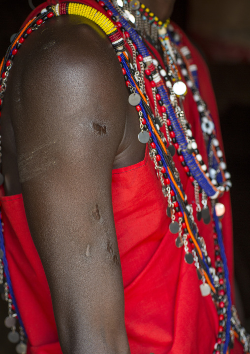 Masai warrior with wounds on his arm made by a lion, Nakuru county, Nakuru, Kenya