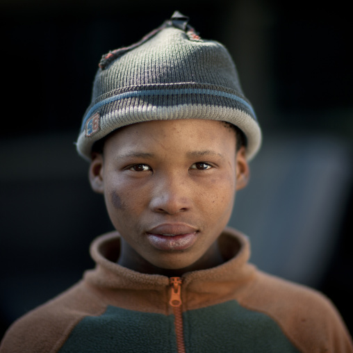 Young Beggar From The San Tribe Called Luca, Wearing Western Clothes, Namibia
