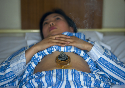 North Korean woman having traditional cupping medicine in Koryo hospital, Pyongan Province, Pyongyang, North Korea