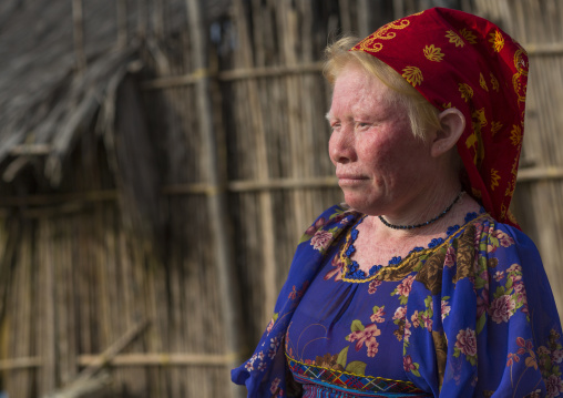 Panama, San Blas Islands, Mamitupu, Portrait Of An Albino Kuna Tribe Woman