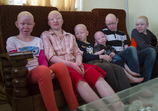 Tanzania, East Africa, Dar es Salaam, teens and children with albinism at under the same sun house