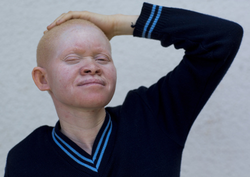 Tanzania, East Africa, Dar es Salaam, miss kabula ngarango a girl with albinism at under the same sun house