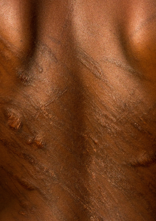 Scars on a hamer tribe woman back after a bull jumping ceremony, Omo valley, Turmi, Ethiopia