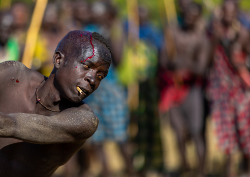 Suri tribe warrior bleeding during a donga stick fighting ritual, Omo valley, Kibish, Ethiopia