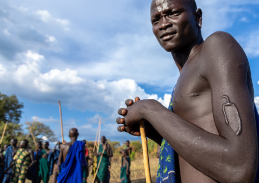 Suri tribe warrior with a scarification on the arm during a donga stick fighting ritual, Omo valley, Kibish, Ethiopia