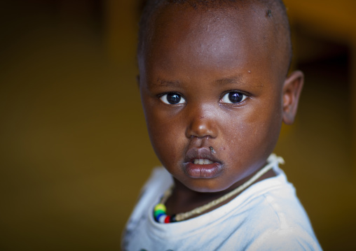 Mingi baby rescued in omochild foundation, Jinka, Omo valley, Ethiopia