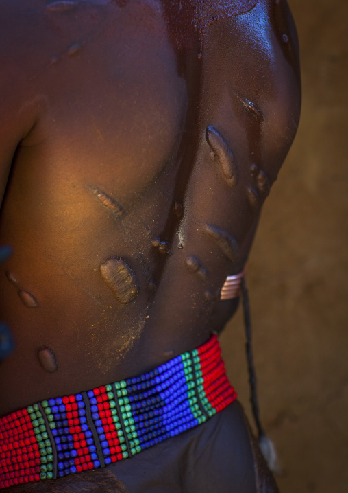 Scars On A Hamer Tribe Woman Back, Turmi, Omo Valley, Ethiopia
