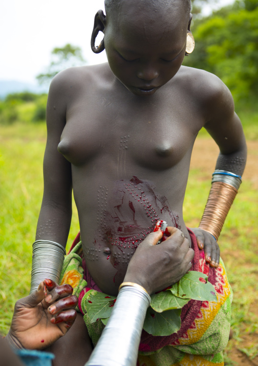 Girl from Suri tribe during a scarification ceremony, Tulgit, Omo valley, Ethiopia
