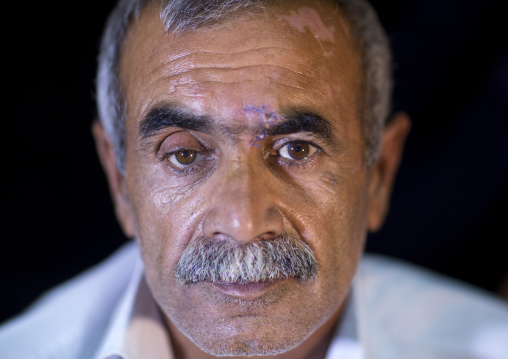 Kurdish Wounded Veteran, Sulaymaniyah, Kurdistan, Iraq