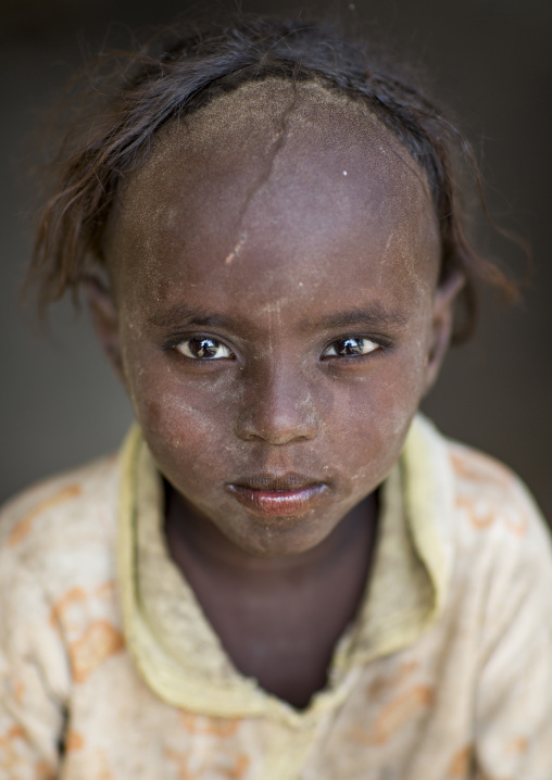 Afar Tribe Girl With Tonsure On The Head To Protect Her From The Bad Spririts, Afambo, Ethiopia