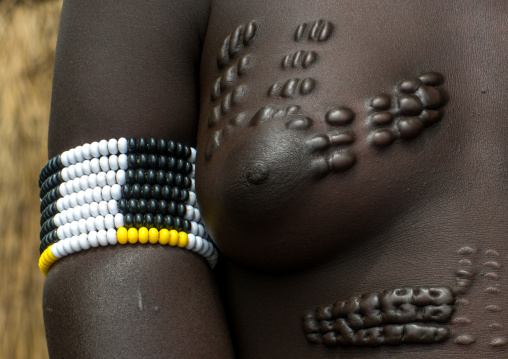 Scarified breast of a mursi tribe woman, Omo valley, Mago park, Ethiopia