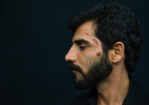 Iranian Shiite Muslim Mourner From The Mad Of Hussein Community With Injuries On His Face Caused By Self-flagellation During Muharram, Isfahan Province, Kashan, Iran