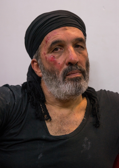 Iranian Shiite Muslim Mourner From The Mad Of Hussein Community With Injuries On His Face Caused By Self-flagellation, Isfahan Province, Kashan, Iran