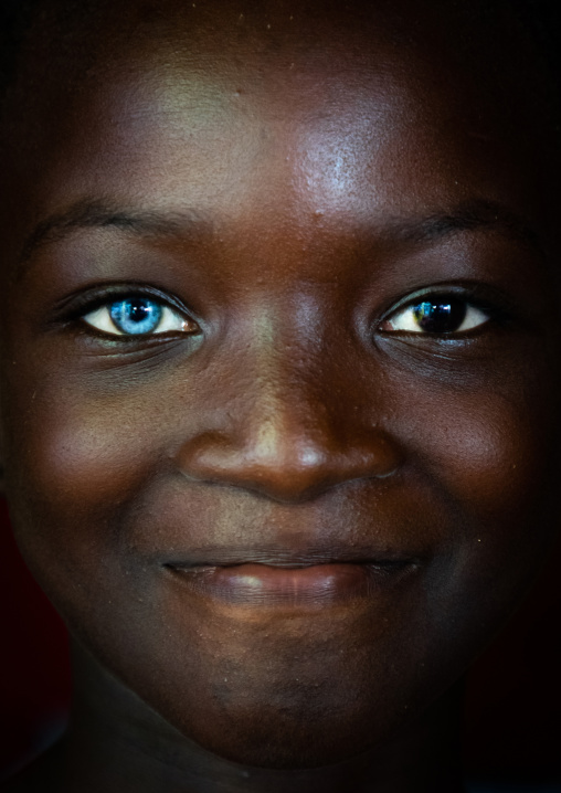 Beautiful african girl with heterochromia iridis causing two different colored eyes, Moyen-Comoé, Abengourou, Ivory Coast