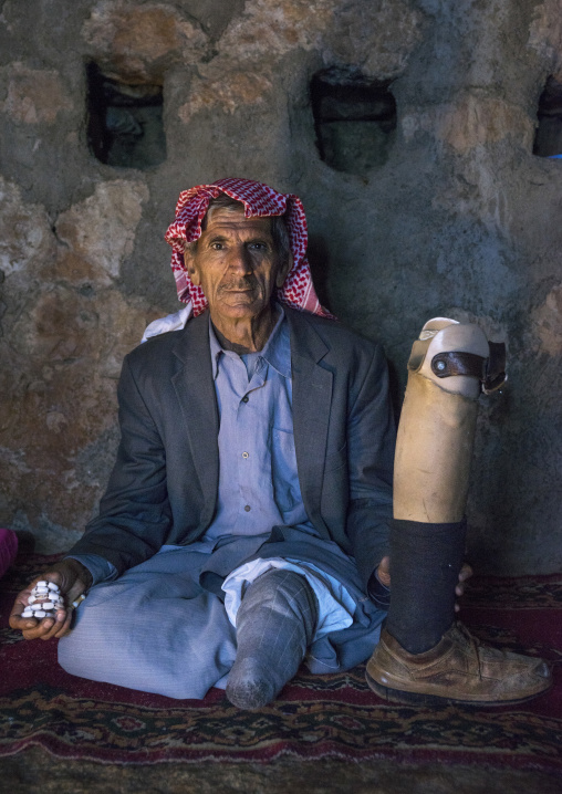 Amputated Yezedi Refugee Man Displaced From Sinjar Who Lives In Lalesh Temple, Kurdistan, Iraq