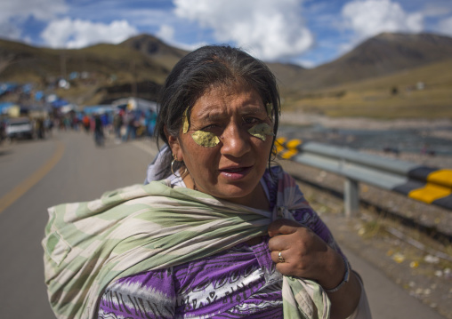 Woman With Coca Leaves On The Face To Cure Headache, Qoyllur Riti Festival, Ocongate Cuzco, Peru