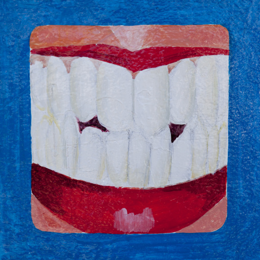 A Painted Advertisement Sign For A Dentist Depicting A Mouth And Teeth On A Blue Background, Boorama, Somaliland