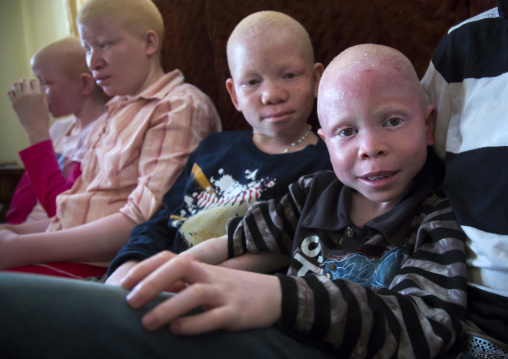 Tanzania, East Africa, Dar es Salaam, albinos teens and children with albinism at under the same sun house